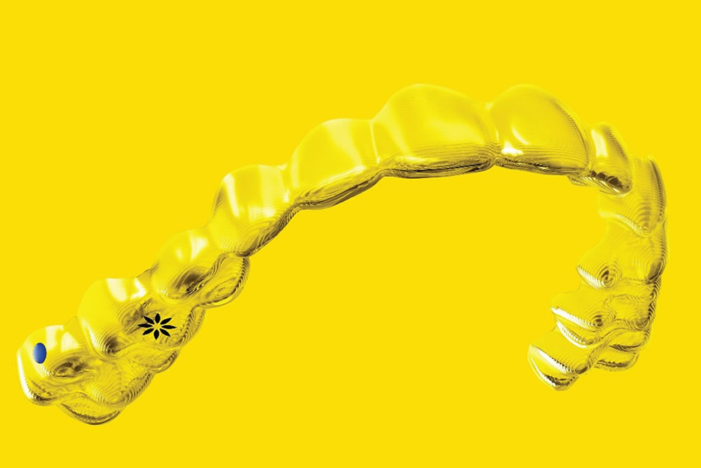 マウスピース型矯正装置インビザラインファースト