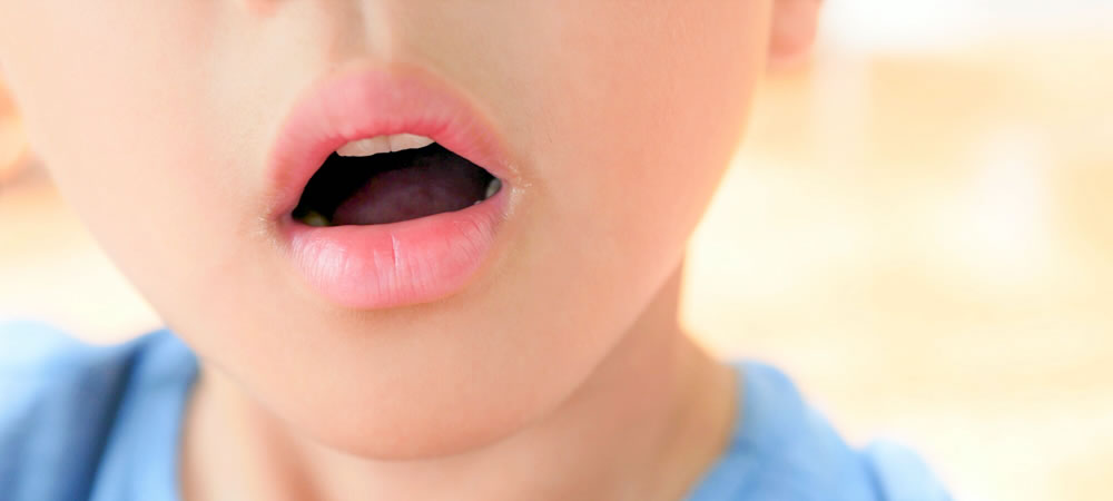 口呼吸(ポカン口)