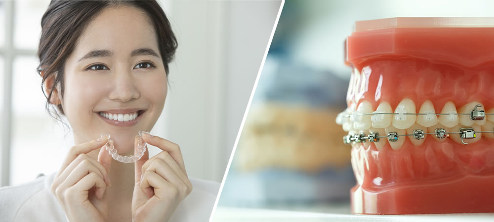 ワイヤー矯正とマウスピース矯正の併用治療