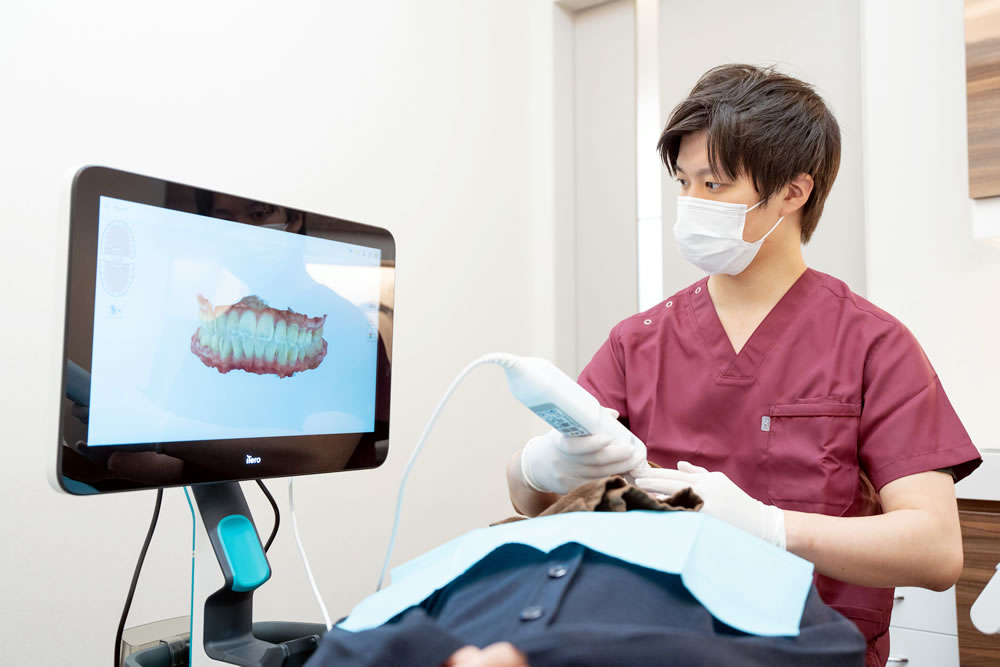 口腔内スキャナーiTero