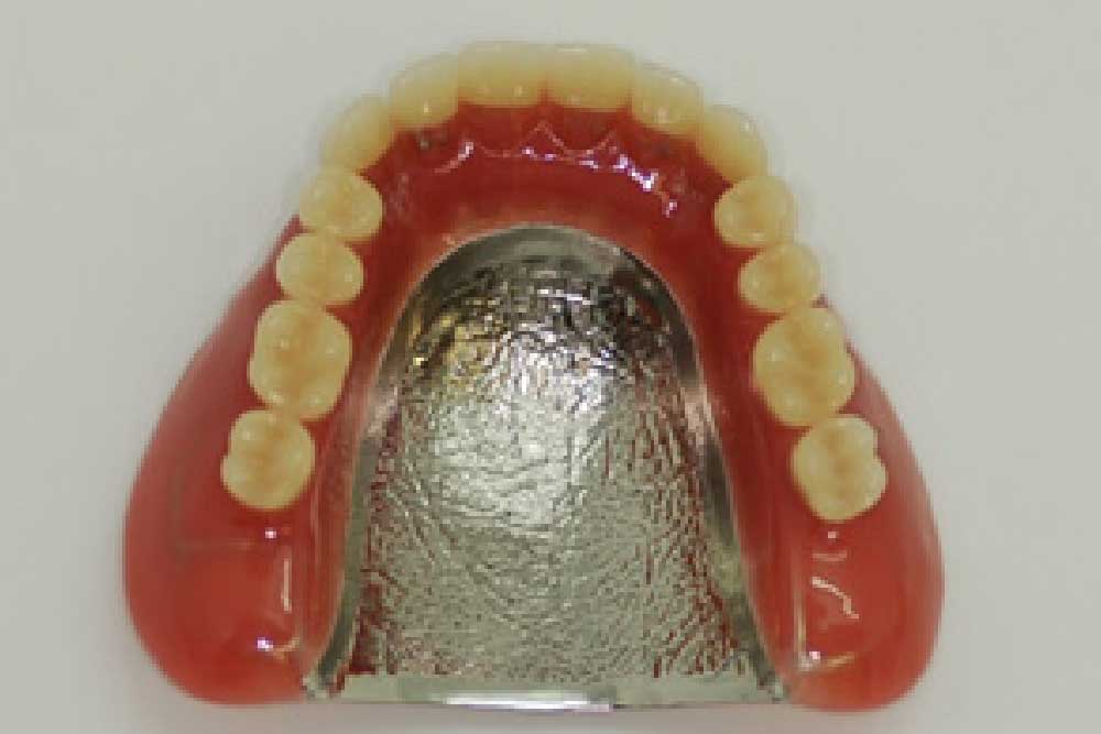 金属床(コバルトクロム)