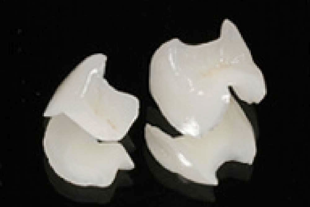 プレミアムセラミック