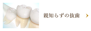 親知らずの抜歯