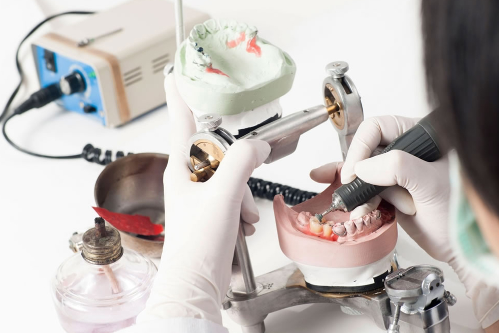 熟練の歯科技工士へ製作を依頼