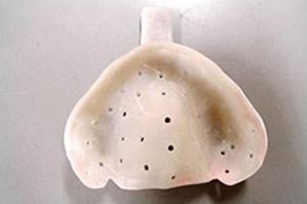 個人トレーによる筋圧形成