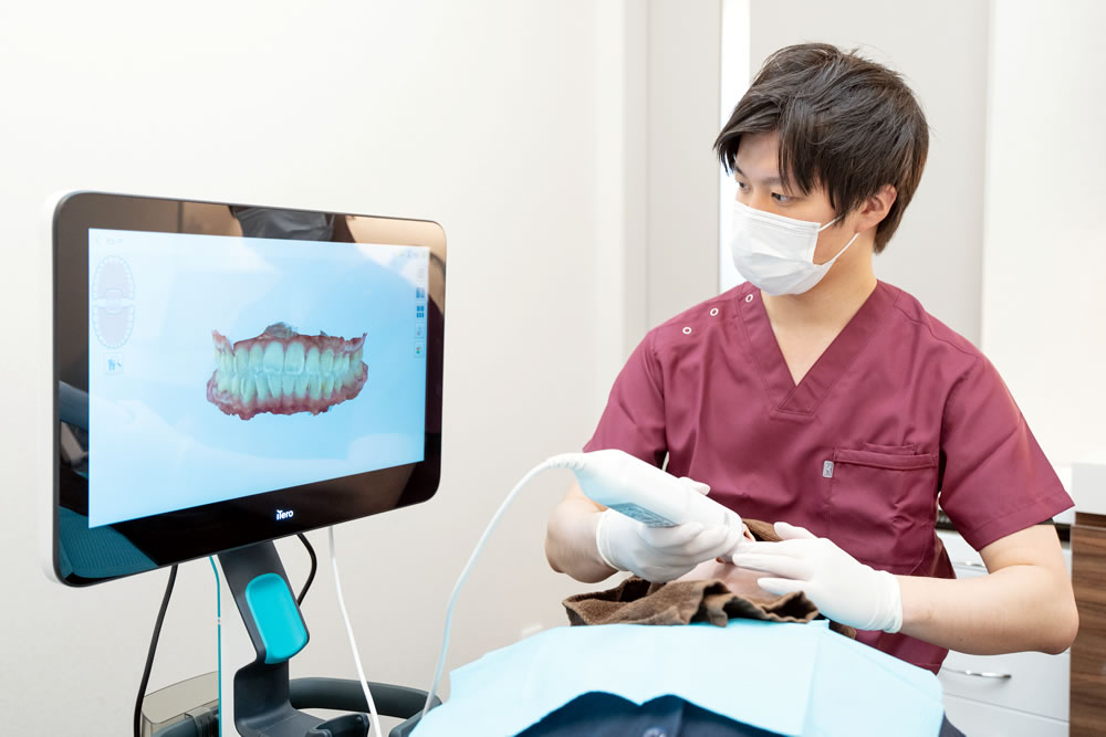 口腔内スキャナーiTero