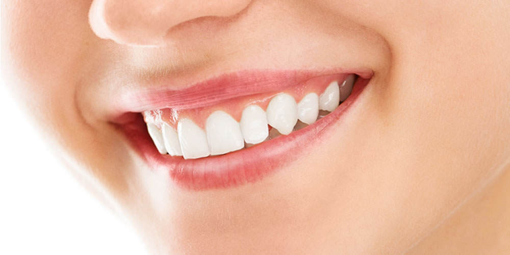 ホワイトニング治療